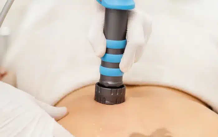 Shockwave Therapy being performed by Marine City MI Chiropractor