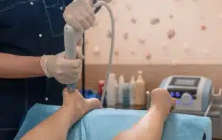 Shockwave being performed on plantar fasciitis by Marine City MI Chiropractor