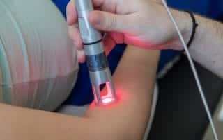 Laser treatment for tennis elbow